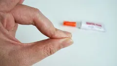 How to remove superglue from your hands at home: 6 effective methods and important tips